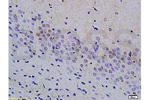 Immunohistochemistry (IHC) image for anti-Mitogen-Activated Protein Kinase Kinase Kinase 9 (MAP3K9) (pThr312) antibody (ABIN872294)