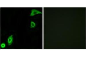 Immunofluorescence analysis of A549 cells, using RPS20 Antibody. (RPS20 antibody  (AA 31-80))