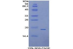 SDS-PAGE of Protein Standard from the Kit (Highly purified E.