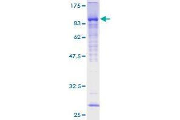 ZNF394 Protein (AA 1-561) (GST tag)