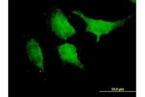 Immunofluorescence of purified MaxPab antibody to TRAF6 on HeLa cell. (TRAF6 antibody  (AA 1-522))