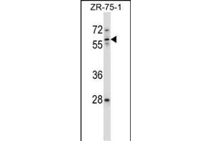IC Antibody (Center) (ABIN657631 and ABIN2846627) western blot analysis in ZR-75-1 cell line lysates (35 μg/lane). (ICAM-3/CD50 antibody  (AA 282-310))
