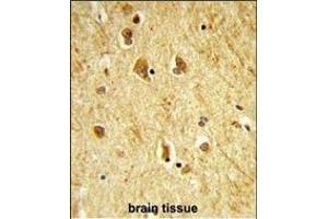 Immunohistochemistry (Paraffin-embedded Sections) (IHC (p)) image for anti-ADAM Metallopeptidase with thrombospondin Type 1 Motif, 18 (ADAMTS18) (AA 1066-1095), (C-Term) antibody (ABIN652853)