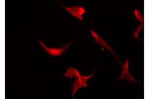 ABIN6266451 staining HeLa by IF/ICC. (CDC25A antibody  (pSer76))