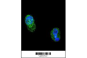 Confocal immunofluorescent analysis of HNF1A Antibody with HepG2 cell followed by Alexa Fluor 488-conjugated goat anti-rabbit lgG (green).