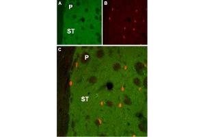 Expression of Muscarinic acetylcholine receptor M1 in rat striatum - Immunohistochemical staining of rat striatum (ST) using Anti-CHRM1 Antibody (ABIN7043060, ABIN7044580 and ABIN7044581). (CHRM1 antibody  (AA 227-353))