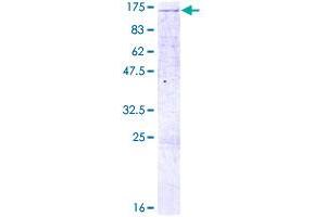 LLGL2 Protein (AA 1-1020) (GST tag)