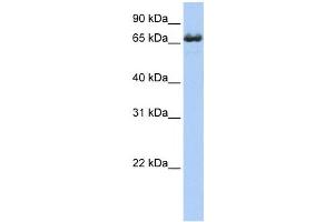 Western Blotting (WB) image for anti-Zinc Finger, DHHC-Type Containing 17 (ZDHHC17) antibody (ABIN2459071) (ZDHHC17 antibody)