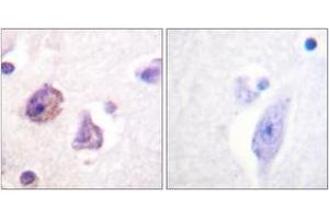 Immunohistochemistry analysis of paraffin-embedded human brain, using FAK (Phospho-Tyr576) Antibody. (FAK antibody  (pTyr576))