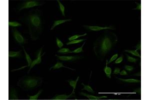 Immunofluorescence of monoclonal antibody to PCNA on HeLa cell. (PCNA antibody  (AA 78-177))