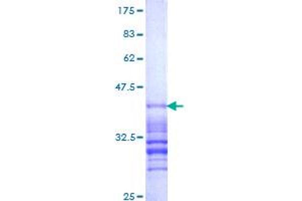 RAB5B Protein (AA 116-215) (GST tag)