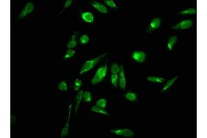 Immunofluorescence staining of Hela cells with ABIN7139270 at 1:2. (HIST1H2AG antibody  (2meArg11))