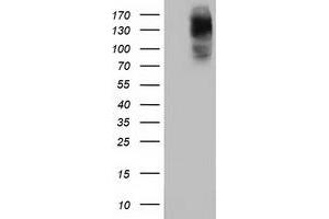 HEK293T cells were transfected with the pCMV6-ENTRY control (Left lane) or pCMV6-ENTRY HDAC6 (Right lane) cDNA for 48 hrs and lysed. (HDAC6 antibody)