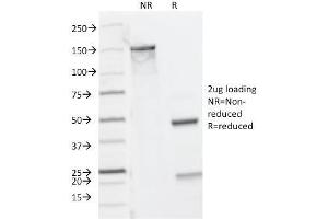 SDS-PAGE Analysis Purified CD8A Mouse Monoclonal Antibody (C8/144B). (CD8 alpha antibody  (C-Term, Cytoplasmic Domain))