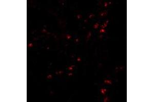 Immunofluorescence of LAMP1 in human colon tissue with LAMP1 polyclonal antibody  at 20 ug/mL . (LAMP1 antibody  (Internal Region))