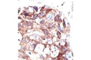 Image no. 2 for anti-Ubiquilin 1 (UBQLN1) (N-Term) antibody (ABIN357617) (Ubiquilin 1 antibody  (N-Term))
