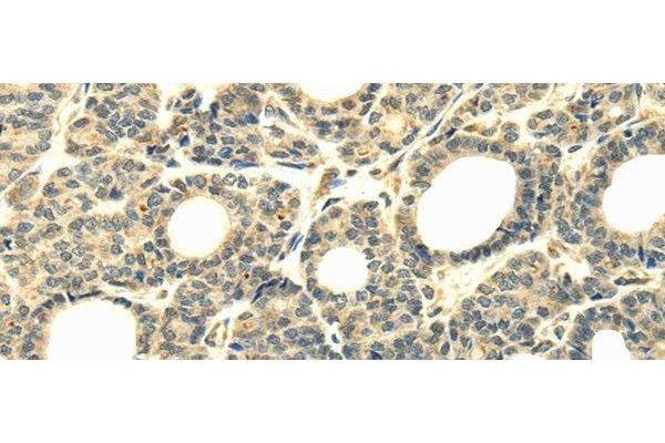 WD Repeat Domain 45B (WDR45B) antibody