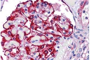 Human Kidney: Formalin-Fixed, Paraffin-Embedded (FFPE) (FREM2 antibody  (Internal Region))