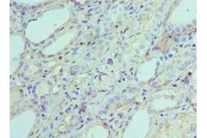Immunohistochemistry of paraffin-embedded human kidney tissue using ABIN7143342 at dilution of 1:100 (Adenylate Kinase 2 antibody  (AA 1-232))