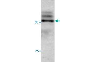 Western blot under reducing conditions on Olfactory cell line (Odora) lysate using rabbit ATG4C polyclonal antibody  at a dilution of 1 : 100. (ATG4C antibody  (C-Term))