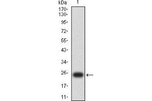 Western blot analysis using S100B mAb against human S100B (AA: 1-92) recombinant protein. (S100B antibody  (AA 1-92))