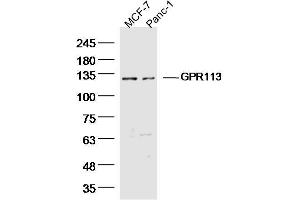 Lane 1: MCF-7 Cell lysates, Lane 2: Panc-1 Cell lysates, probed with GPR113 Polyclonal Antibody, unconjugated  at 1:300 overnight at 4°C followed by a conjugated secondary antibody for 60 minutes at 37°C. (GPR113 antibody  (AA 1-100))
