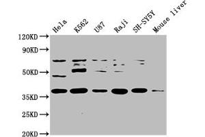 Western Blot Positive WB detected in: Hela whole cell lysate, K562 whole cell lysate, U87 whole cell lysate, Raji whole cell lysate, SH-SY5Y whole cell lysate, Mouse liver tissue All lanes: SS18L1 antibody at 1:2000 Secondary Goat polyclonal to rabbit IgG at 1/50000 dilution Predicted band size: 43, 41, 34, 30, 44 kDa Observed band size: 43 kDa (SS18L1 antibody  (AA 47-396))