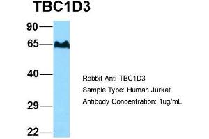 Host: Rabbit Target Name: TBC1D3 Sample Type: Human Jurkat Antibody Dilution: 1. (TBC1D3 antibody  (C-Term))