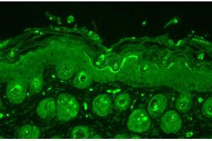 Immunohistochemistry analysis using Rabbit Anti-Ubiquitin Polyclonal Antibody . (Ubiquitin antibody  (PerCP))