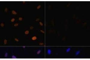 Immunofluorescence analysis of NIH/3T3 cells using Acetyl-Histone H4-K16 Polyclonal Antibody at dilution of 1:100. (Histone H4 antibody  (acLys16))