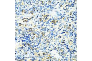 Immunohistochemistry of paraffin-embedded rat spleen using SLC25 antibody (ABIN6132660, ABIN6147903, ABIN6147904 and ABIN6224187) at dilution of 1:100 (40x lens). (SLC25A11 antibody  (AA 1-314))