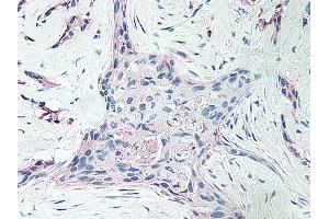 Image no. 1 for anti-Platelet Factor 4 (PF4) antibody (ABIN465152) (PF4 antibody)