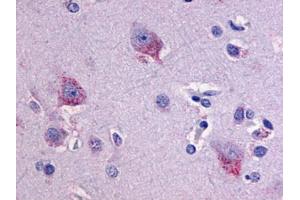 Anti-LPHN1 antibody IHC of human brain, neurons and glia. (Latrophilin 1 antibody  (C-Term))