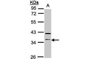 WB Image Sample(30 ug whole cell lysate) A:Raji , 10% SDS PAGE antibody diluted at 1:500 (RASSF2 antibody  (Center))