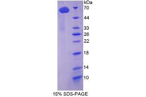 Image no. 1 for Tubulin, delta 1 (TUBD1) (AA 190-453) protein (His tag,GST tag) (ABIN4990290)