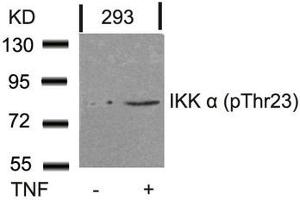 Western blot analysis of extracts from 293 cells untreated or treated with TNF using IKK a(Phospho-Thr23) Antibody. (IKK alpha antibody  (pThr23))