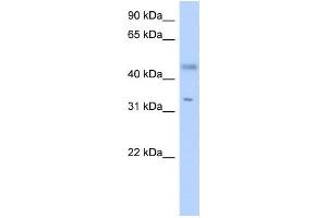 Western Blotting (WB) image for anti-Epidermal Retinal Dehydrogenase 2 (RDHE2) antibody (ABIN2459555) (SDR16C5 antibody)