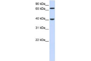 WB Suggested Anti-PDLIM3 Antibody Titration: 0. (PDLIM3 antibody  (N-Term))