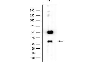 anti-Nicotinamide Nucleotide Adenylyltransferase 3 (NMNAT3) antibody