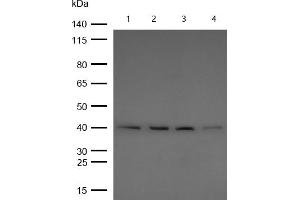 All lanes : BMP6 Rabbit mAb at 1/1k dilution Lane 1 : Mouse Lung lysates Lane 2 : Rat Brain lysates Lane 2 : Rat Kidney lysates Lane 3 : Rat Lung lysates Lysates/proteins at 20 μg per lane. (Recombinant BMP6 antibody)