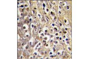 AP14221PU-N CYP19A1 antibody staining of Formalin-Fixed, Paraffin-Embedded Human placenta tissue using peroxidase-conjugate and DAB chromogen. (Aromatase antibody  (C-Term))