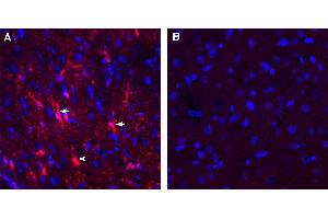 Expression of GPR12 in rat cortex.