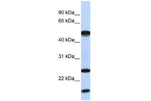 UBE2L6 antibody used at 1 ug/ml to detect target protein. (UBE2L6 antibody  (N-Term))