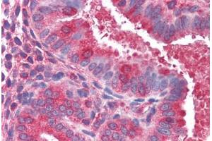Human Uterus (formalin-fixed, paraffin-embedded) stained with ACTR1B antibody ABIN351475 at 3. (ACTR1B antibody  (AA 363-375))