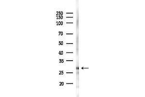 anti-C-Type Lectin Domain Family 1, Member B (CLEC1B) antibody