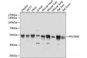 Western blot analysis of extracts of various cell lines using PACSIN3 Polyclonal Antibody at dilution of 1:1000. (PACSIN3 antibody)
