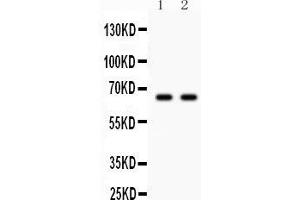 Western blot testing of Parkin antibody and Lane 1:  U87;  2: mouse brain lysate. (Parkin antibody  (AA 23-416))