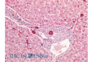 ABIN1781977 (5µg/ml) staining of paraffin embedded Human Liver. (Cytokeratin 19 antibody  (C-Term))