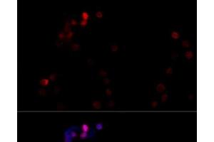 Immunofluorescence analysis of NIH/3T3 cells using TBP Polyclonal Antibody at dilution of 1:100 (40x lens). (TBP antibody)