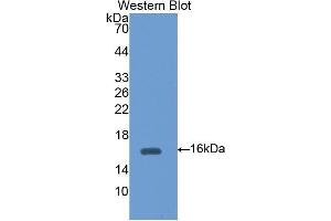 Western Blotting (WB) image for anti-Diazepam Binding Inhibitor (DBI) (AA 1-104) antibody (ABIN1176159) (Diazepam Binding Inhibitor antibody  (AA 1-104))